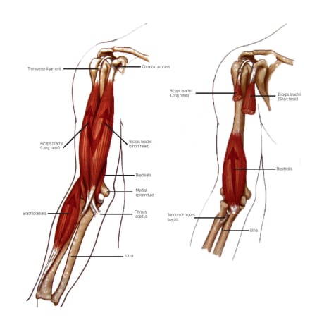 Vond albue: Illustrasjonen viser de tre primærfleksorene i albueleddet: M. biceps brachii, m.brachioradialis og m.brachialis. Legg merke til hvor Brachialis ligger plassert under bicepsmuskelen og hvordan denne lokalisasjonen stemmer overens med hvor de fleste angir å ha vondt når de har «Climber’s Elbow».